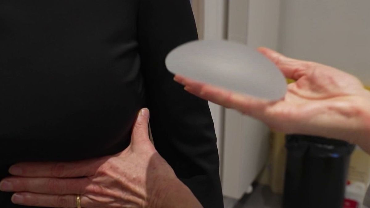 Quand la beauté naturelle reprend ses droits : le retour des adeptes de la chirurgie esthétique